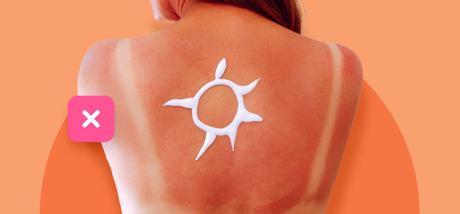 Costas com marcas de proteção solar em formato de sol
