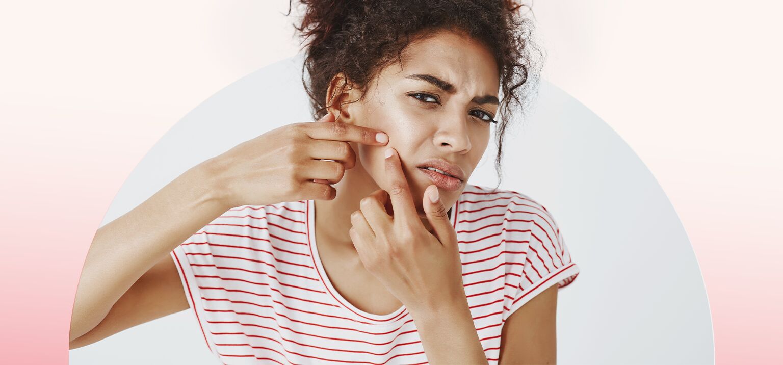 Mulher com acne com expressão de desconforto