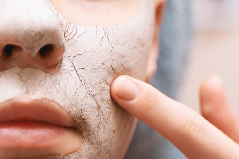 Close-up de rosto com pele seca e descamando, ilustrando a necessidade de skincare pele seca produtos para hidratar, reparar e aliviar o ressecamento.